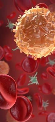 Thrombophlebitis