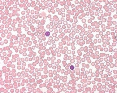 Universitätsklinikum Frankfurt - Lymphozyten Darstellung