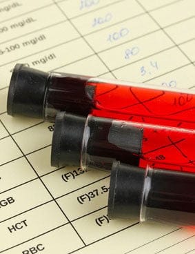 Anzahl der Thrombozyten