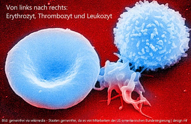 Thrombozytopathie