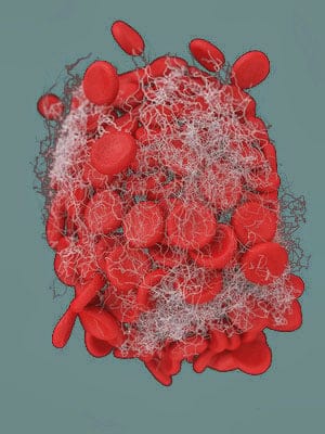 Thrombozytenaggregation