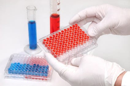 Laborsituation / Lymphozyten Werte erhöht