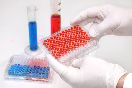 Laborsituation / Lymphozyten Werte erhöht