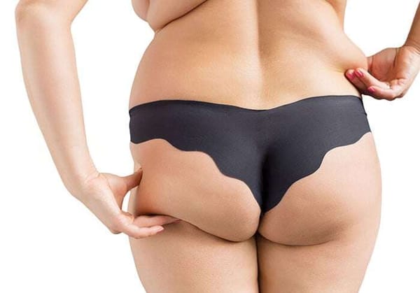 Vitamin D gegen Übergewicht – Bedeutung und Ursachen