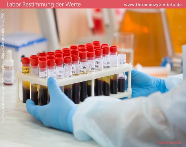 Thrombozytopenie Symptome erkennen und behandeln?