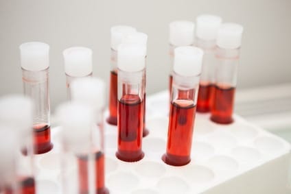 Thrombozyten im Citratblut zu niedrig