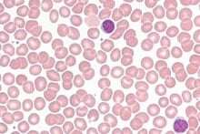 Lymphozytenzahl