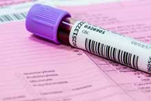 Non-Hodgkin-Lymphom Symptome