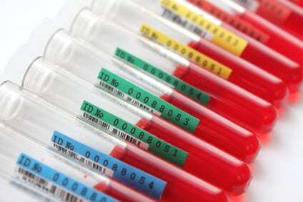 Lymphozyten bei Rheuma niedrig?