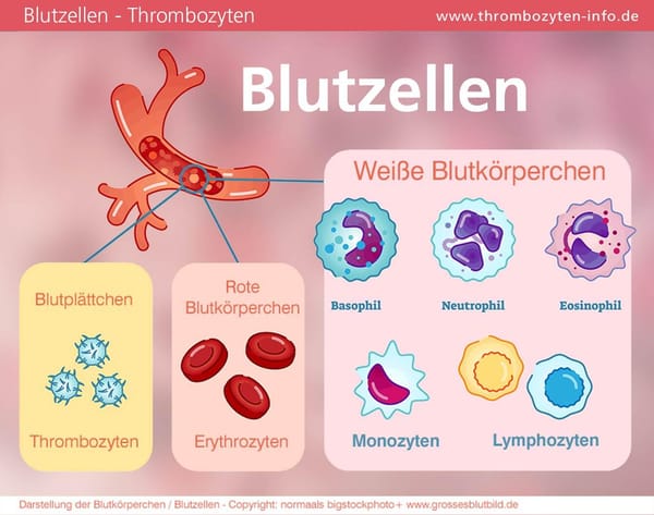 Thrombophlebitis