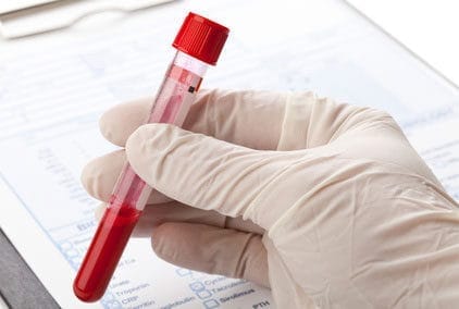 Thrombozyten senken – Methoden und Fakten